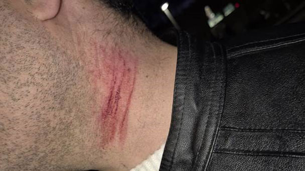 Angriff auf Taxifahrer in Gernsbach – Holl AG verurteilt Gewalttat Angriff auf Taxifahrer in Gernsbach – Holl AG verurteilt Gewalttat